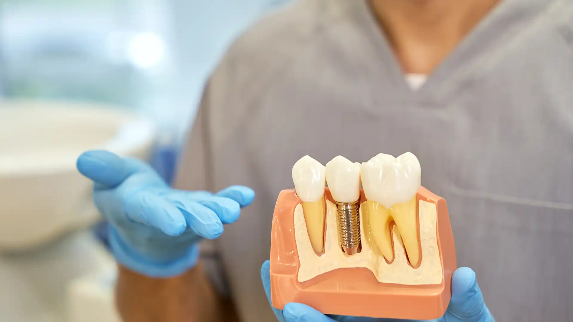 Dental implant in Turkey 